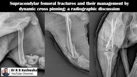 tibial compression test dog|femoral head fracture in dogs.